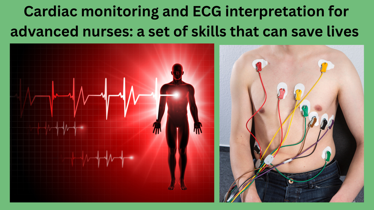 Cardiac-monitoring-and-ECG-interpretation-for-advanced-nurses-a-set-of-skills-that-can-save-lives
