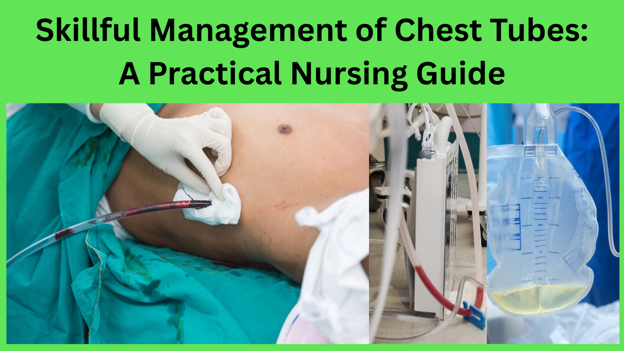 Skillful Management of Chest Tubes: A Practical Nursing Guide.