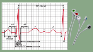 ECG GRAPH
